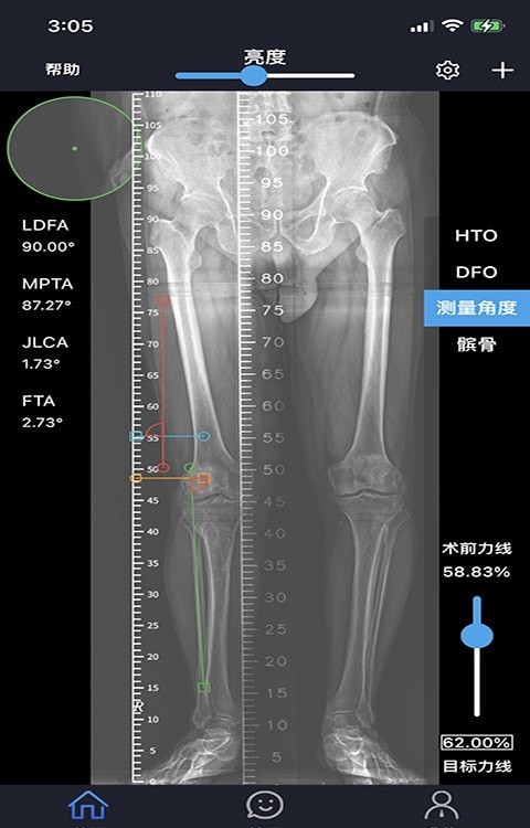 华保膝望截图2