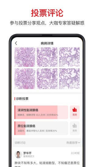 爱病理截图3